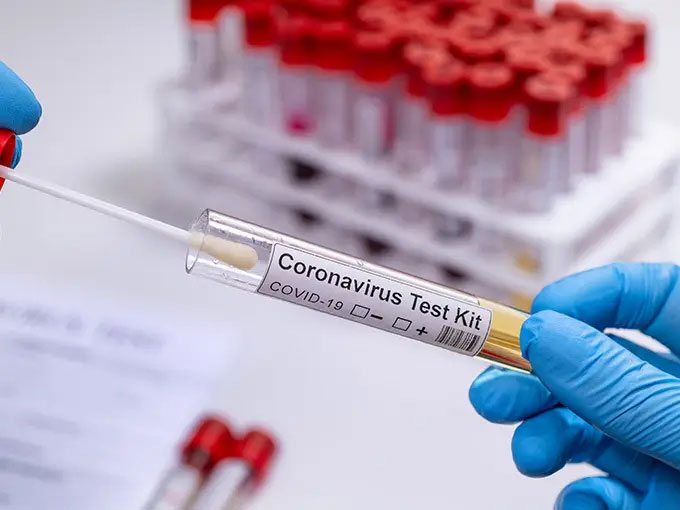 Urgent COVID-19 test shipments